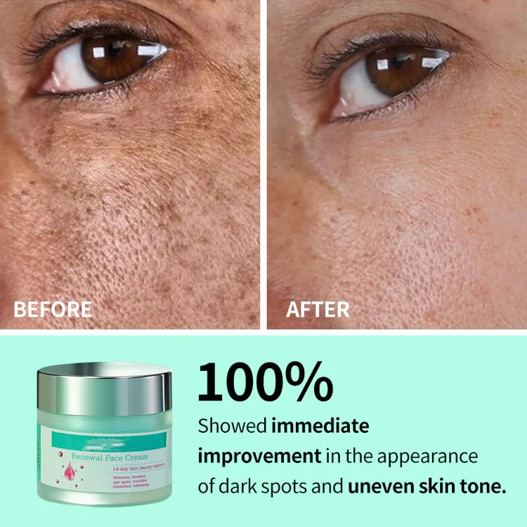 Official Store🌟 Professional Skin Renewal Cream