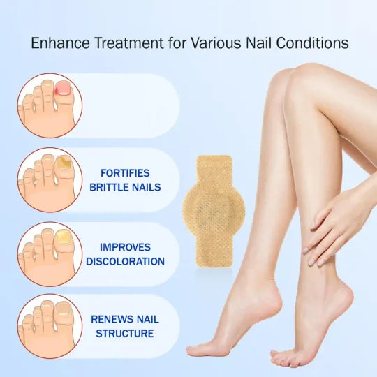Onychomycosis patches, 21 pieces/box nail care patches, onychomycosis care patches