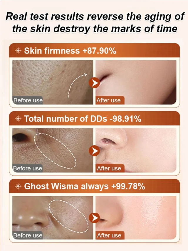 ✨Ecdoin anti aging essence