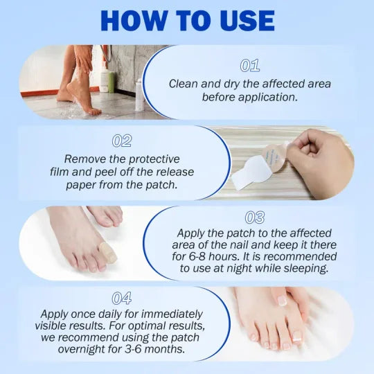 Onychomycosis patches, 21 pieces/box nail care patches, onychomycosis care patches