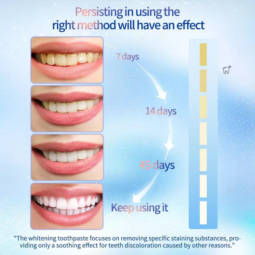 🔥 Japanese Patent🔥 Niacinamide Whitening Toothpaste